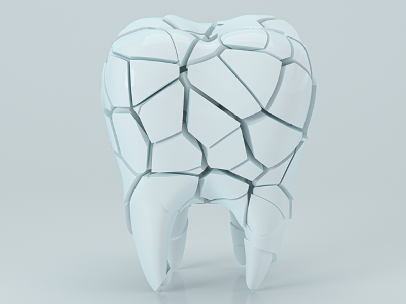 Cracked 3D Tooth
