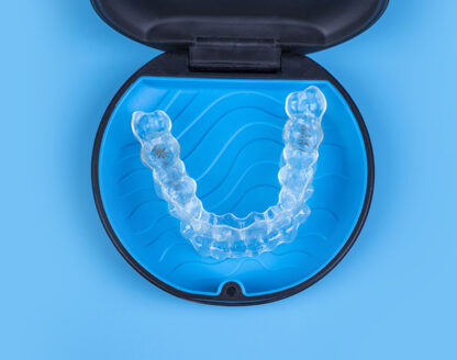 6 reasons Invisalign® is a patient-friendly alternative to braces 