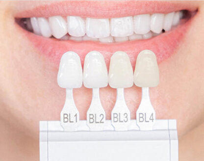 Learn more about veneers, the most popular cosmetic dentistry procedure around! 