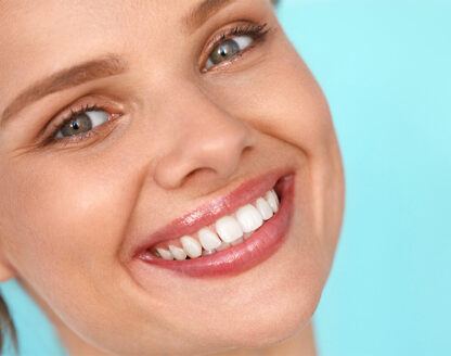 6 ways that we make over smiles with veneers 