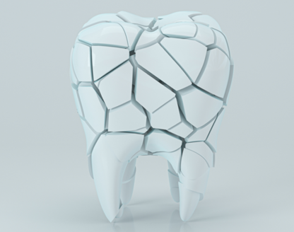 Is Bruxism the Cause of Your Damaged Teeth? 