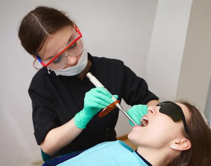 Can Composite Fillings Fix Chipped or Cracked Teeth? 